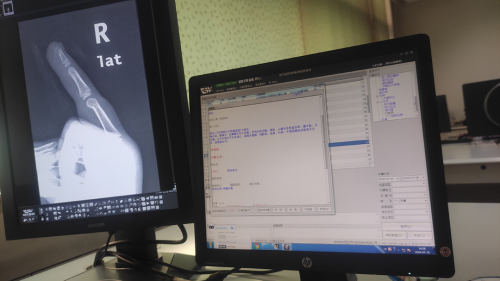 告别智能门锁夹手隐患 王力安防从设计源头重构安全逻辑