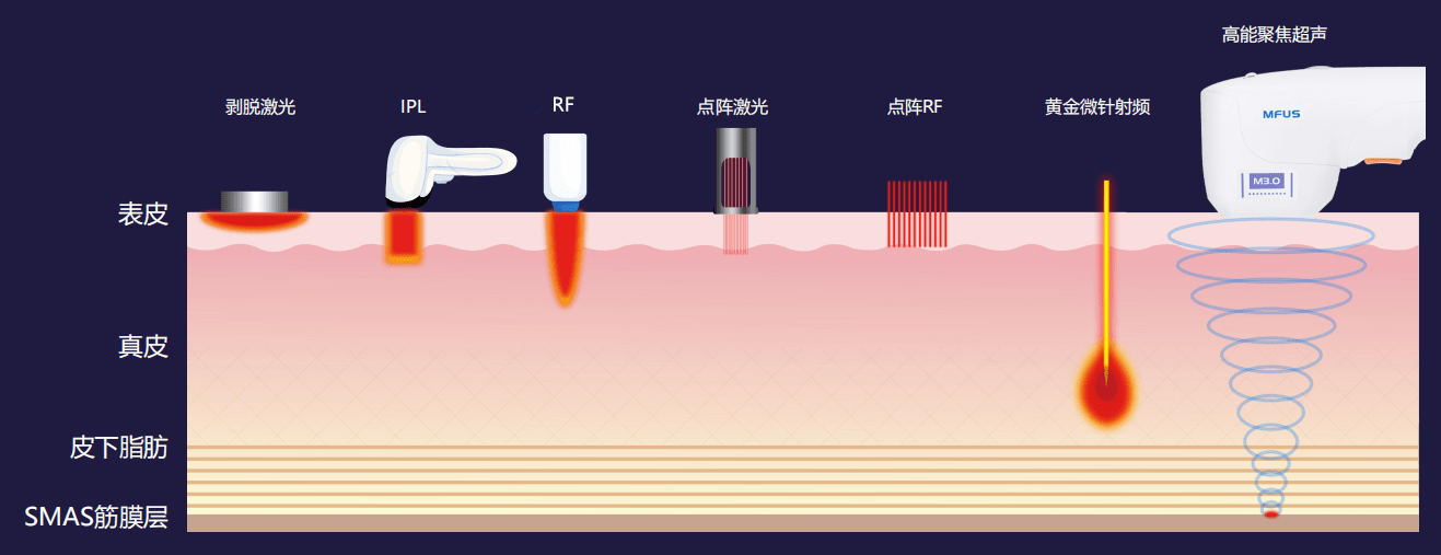 兴森科技：公司CSP封装基板业务目前订单持续向好满产满销扩产后将继续聚焦存储射频两大主力方向并向汽车市场拓展