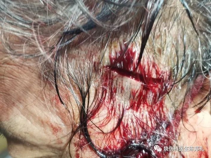 餐厅送餐机器人撞伤孩子谁担责?