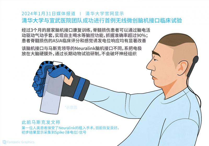 “软硬兼施”培育脑机接口产业