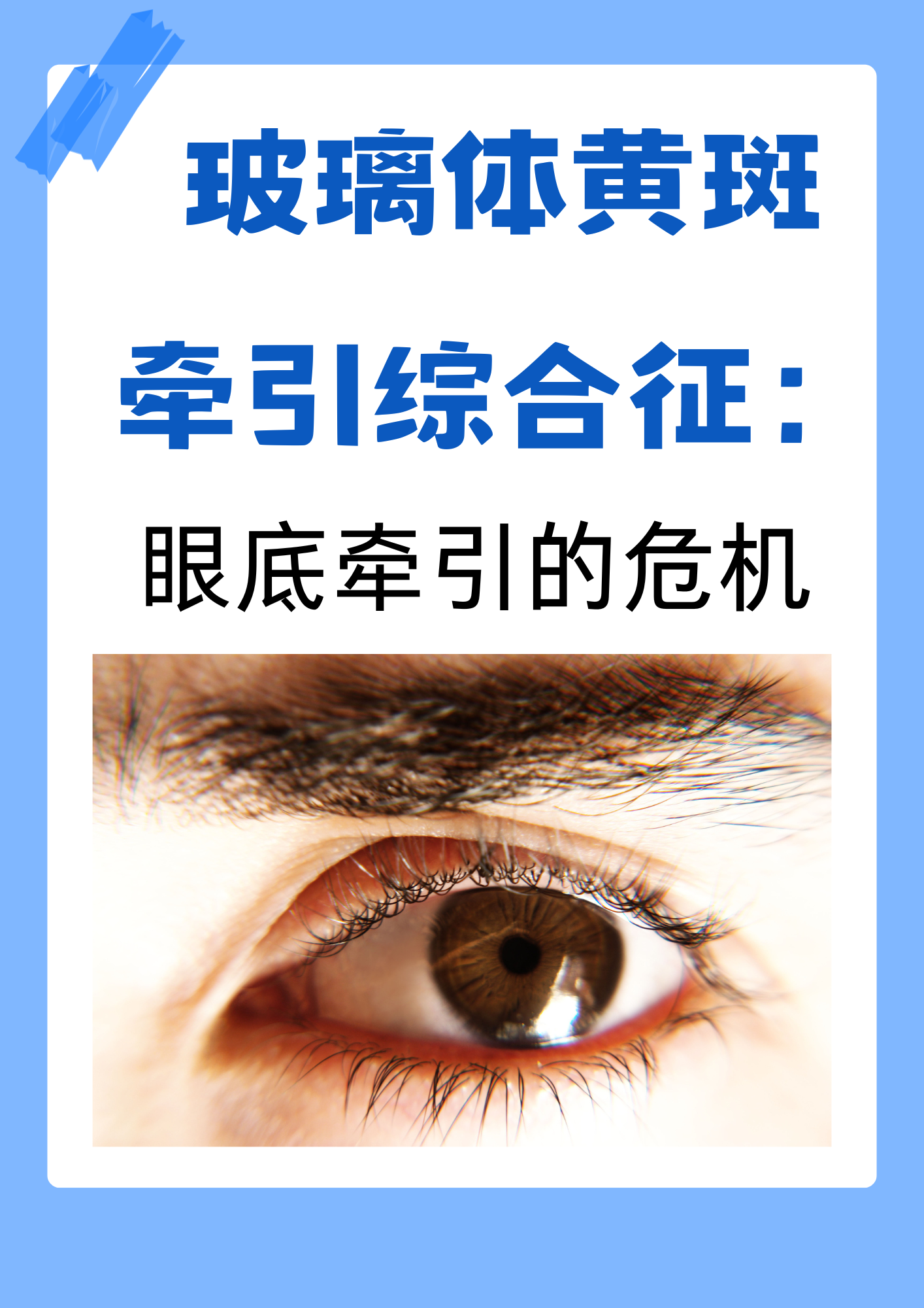 新型眼部植入系统帮助黄斑变性失明患者恢复视力