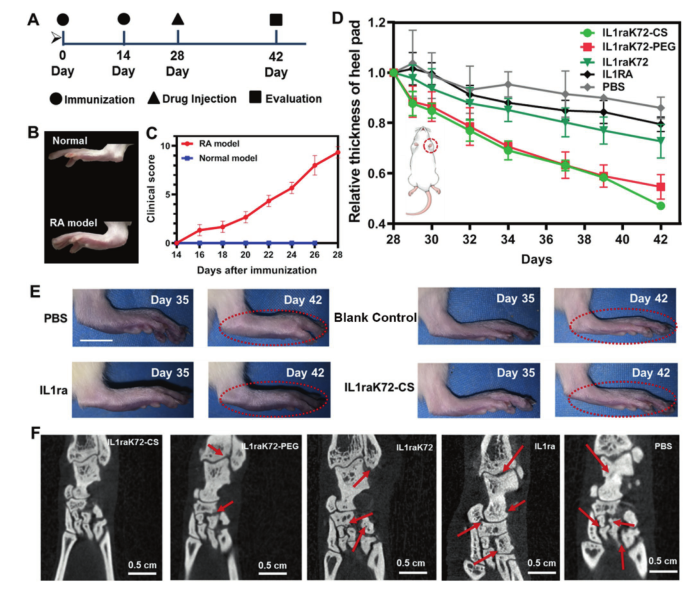 新型纳米颗粒助力骨关节炎早期识别