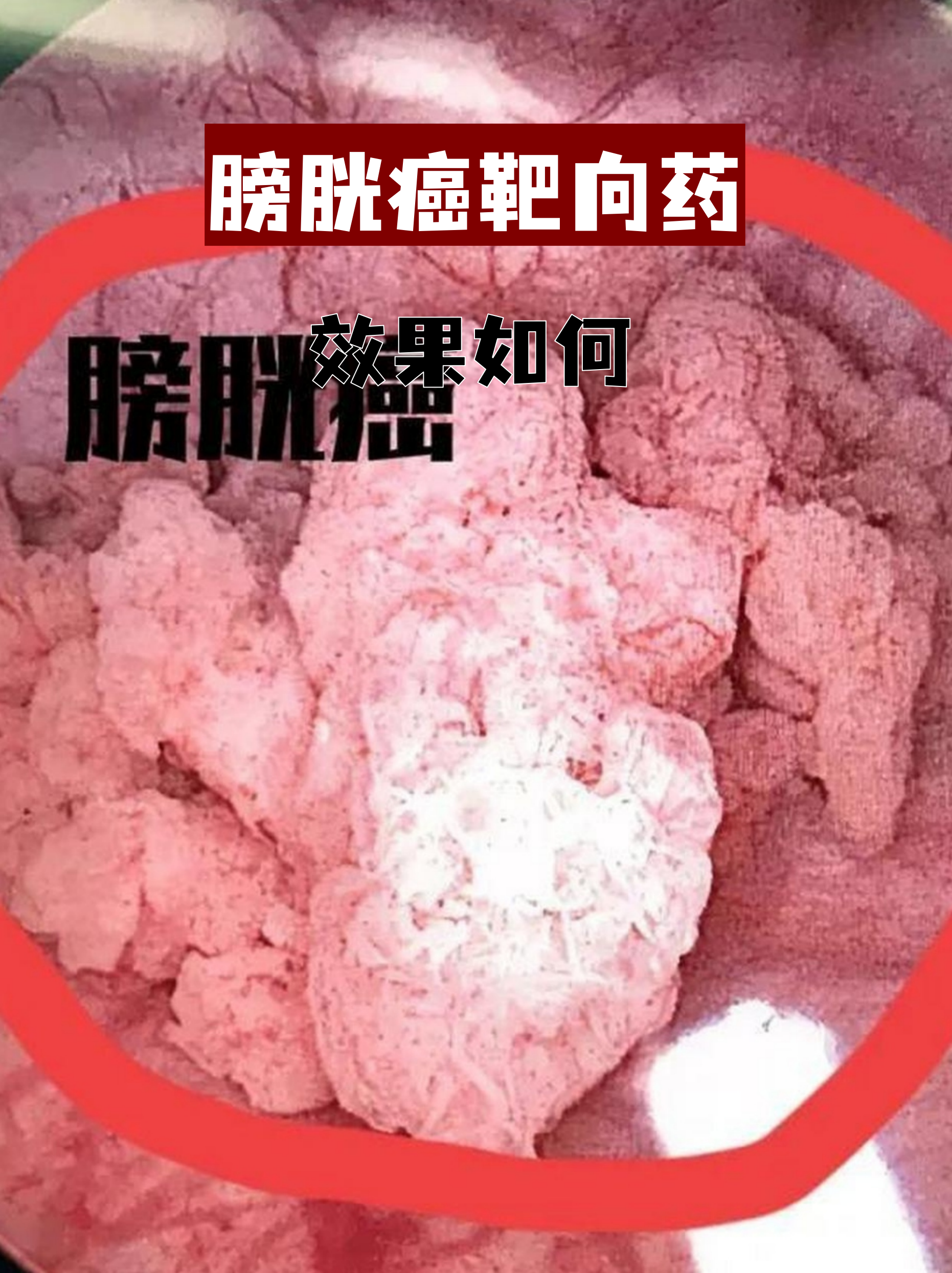 百利天恒：iza-bren（EGFR×HER3双抗ADC）联合用药治疗晚期或广泛期实体瘤获得2个II/III期药物临床试验批准通知书